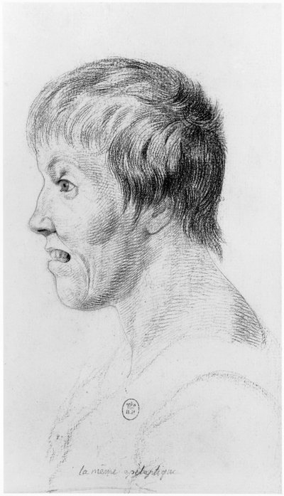 Epileptische Frau, Profil, Illustration aus einem unveröffentlichten Traktat von Jean Etienne Dominique Esquirol (1772-1840) über die Verrückten des Salpetriere-Asyls, ca. 1818 von Georges Francois Gabriel